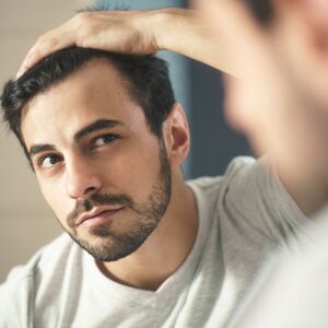 The Most Common Questions About Hair Transplant