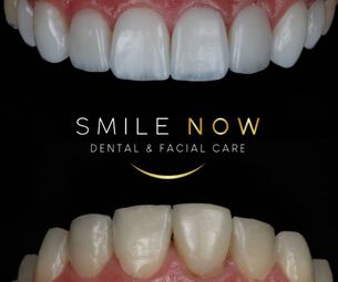 Smile Now Dental & Facial Care