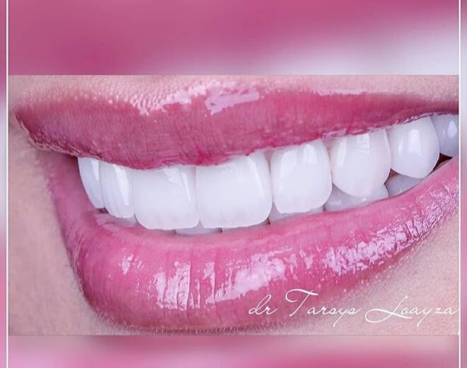 Sonrisa Perfecta Dental - Tarsys Loayza Roys
